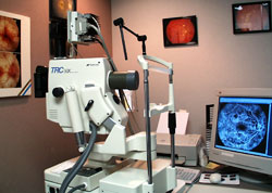 FlouresceinAngiography