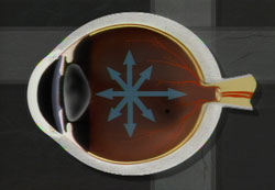 OpticNerve