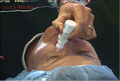 eyearea
